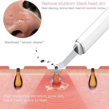 Face Blackhead Remover